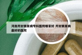 河南開(kāi)封銀屑病專科醫(yī)院哪家好 開(kāi)封銀屑病最好的醫(yī)院