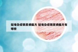 疑難雜癥銀屑病偏方 疑難雜癥銀屑病偏方有哪些