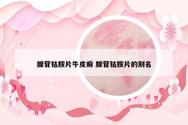 腺苷鈷胺片牛皮癬 腺苷鈷胺片的別名
