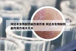 阿達木生物制劑副作用作用 阿達木生物制劑副作用作用大不大