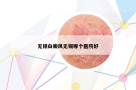 無(wú)錫白癜風(fēng)無(wú)錫哪個(gè)醫(yī)院好