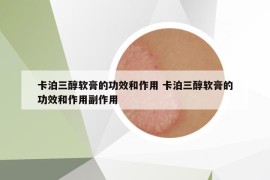 卡泊三醇軟膏的功效和作用 卡泊三醇軟膏的功效和作用副作用