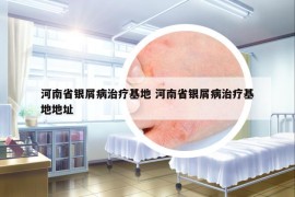 河南省銀屑病治療基地 河南省銀屑病治療基地地址