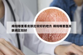 綿陽(yáng)哪里看皮膚比較好的地方 綿陽(yáng)哪里醫(yī)皮膚病比較好