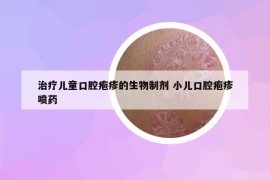 治療兒童口腔皰疹的生物制劑 小兒口腔皰疹噴藥