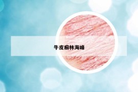牛皮癬林海峰