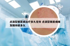 點(diǎn)滴型銀屑病治療多久見效 點(diǎn)滴型銀屑病爆發(fā)期持續(xù)多久