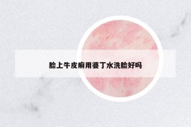 臉上牛皮癬用婆丁水洗臉好嗎