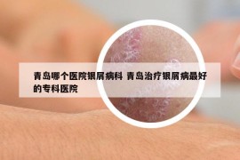 青島哪個醫(yī)院銀屑病科 青島治療銀屑病最好的?？漆t(yī)院