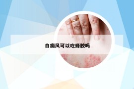 白癜風(fēng)可以吃蜂膠嗎