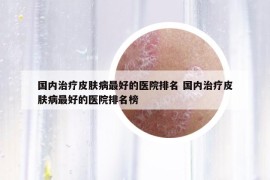 國內治療皮膚病最好的醫(yī)院排名 國內治療皮膚病最好的醫(yī)院排名榜