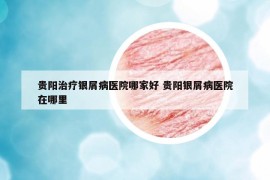 貴陽治療銀屑病醫(yī)院哪家好 貴陽銀屑病醫(yī)院在哪里