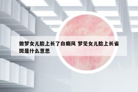做夢(mèng)女兒臉上長(zhǎng)了白癜風(fēng) 夢(mèng)見(jiàn)女兒臉上長(zhǎng)雀斑是什么意思