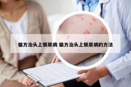偏方治頭上銀屑病 偏方治頭上銀屑病的方法