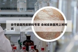 會(huì)守縣醫(yī)院皮膚科專(zhuān)家 會(huì)城皮膚醫(yī)院上班時(shí)間