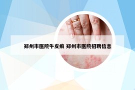 鄭州市醫(yī)院牛皮癬 鄭州市醫(yī)院招聘信息