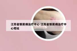 江蘇省銀屑病治療中心 江蘇省銀屑病治療中心地址
