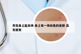 天生身上起白塊 身上有一塊白色的皮膚 出生就有