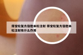 得寶松復(fù)方倍他米松注射 得寶松復(fù)方倍他米松注射有什么作用