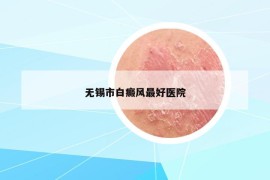 無(wú)錫市白癜風(fēng)最好醫(yī)院