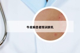 牛皮癬患者擦潤膚乳