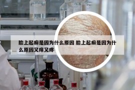 臉上起癬是因?yàn)槭裁丛?臉上起癬是因?yàn)槭裁丛蛴职W又疼