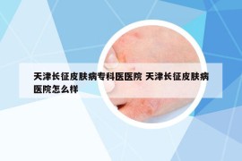 天津長(zhǎng)征皮膚病專科醫(yī)醫(yī)院 天津長(zhǎng)征皮膚病醫(yī)院怎么樣