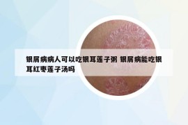 銀屑病病人可以吃銀耳蓮子粥 銀屑病能吃銀耳紅棗蓮子湯嗎
