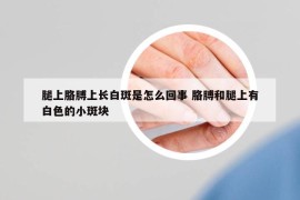 腿上胳膊上長白斑是怎么回事 胳膊和腿上有白色的小斑塊