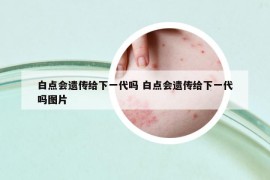 白點(diǎn)會(huì)遺傳給下一代嗎 白點(diǎn)會(huì)遺傳給下一代嗎圖片