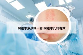 阿達(dá)木多少錢一針 阿達(dá)木幾針有效