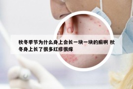 秋冬季節(jié)為什么身上會(huì)長(zhǎng)一塊一塊的癬啊 秋冬身上長(zhǎng)了很多紅疹很癢