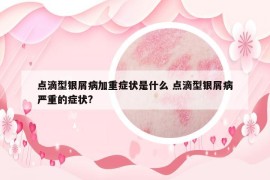 點(diǎn)滴型銀屑病加重癥狀是什么 點(diǎn)滴型銀屑病嚴(yán)重的癥狀?