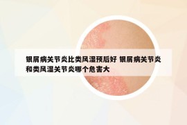 銀屑病關節(jié)炎比類風濕預后好 銀屑病關節(jié)炎和類風濕關節(jié)炎哪個危害大