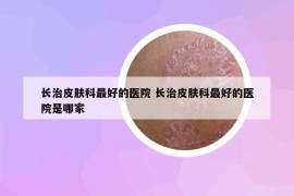 長治皮膚科最好的醫(yī)院 長治皮膚科最好的醫(yī)院是哪家