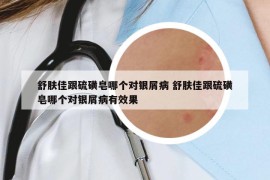 舒膚佳跟硫磺皂哪個對銀屑病 舒膚佳跟硫磺皂哪個對銀屑病有效果