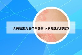 大黃蛭蟲丸治療牛皮癬 大黃蛭蟲丸的功效