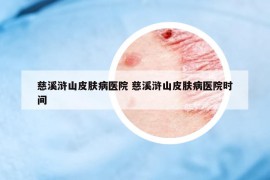 慈溪滸山皮膚病醫(yī)院 慈溪滸山皮膚病醫(yī)院時間