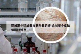 運(yùn)城那個運(yùn)城看皮膚科看的好 運(yùn)城哪個皮膚病醫(yī)院好點(diǎn)
