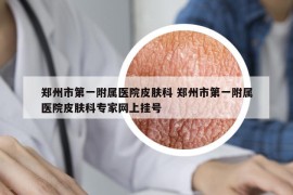 鄭州市第一附屬醫(yī)院皮膚科 鄭州市第一附屬醫(yī)院皮膚科專家網(wǎng)上掛號