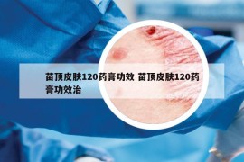 苗頂皮膚120藥膏功效 苗頂皮膚120藥膏功效治