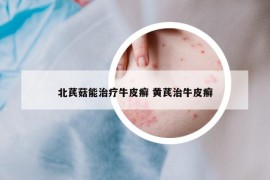 北芪菇能治療牛皮癬 黃芪治牛皮癬