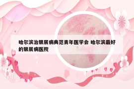 哈爾濱治銀屑病典范青年醫(yī)學(xué)會 哈爾濱最好的銀屑病醫(yī)院