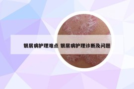 銀屑病護理難點 銀屑病護理診斷及問題
