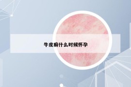 牛皮癬什么時(shí)候懷孕