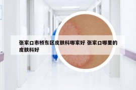 張家口市橋東區(qū)皮膚科哪家好 張家口哪里的皮膚科好