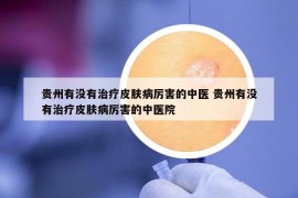 貴州有沒有治療皮膚病厲害的中醫(yī) 貴州有沒有治療皮膚病厲害的中醫(yī)院