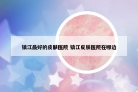 鎮(zhèn)江最好的皮膚醫(yī)院 鎮(zhèn)江皮膚醫(yī)院在哪邊