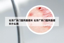 北京廣安門(mén)醫(yī)院最擅長(zhǎng) 北京廣安門(mén)醫(yī)院最擅長(zhǎng)什么病