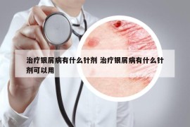 治療銀屑病有什么針劑 治療銀屑病有什么針劑可以用